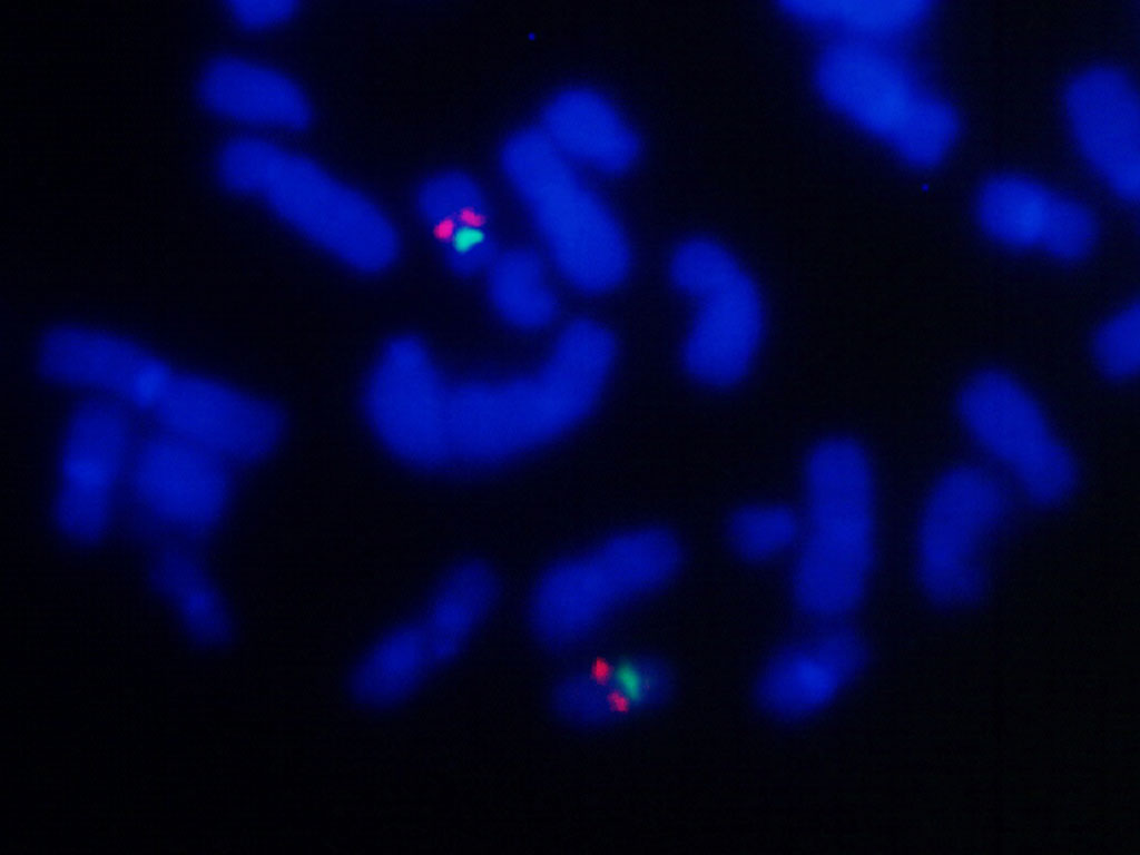 Terc Red And Chromosome 3 Centromere Green Fish Probe