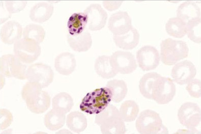 Dimorphic Nature Of Plasmodium Ovale Curitsi And Plasmodium Ovale