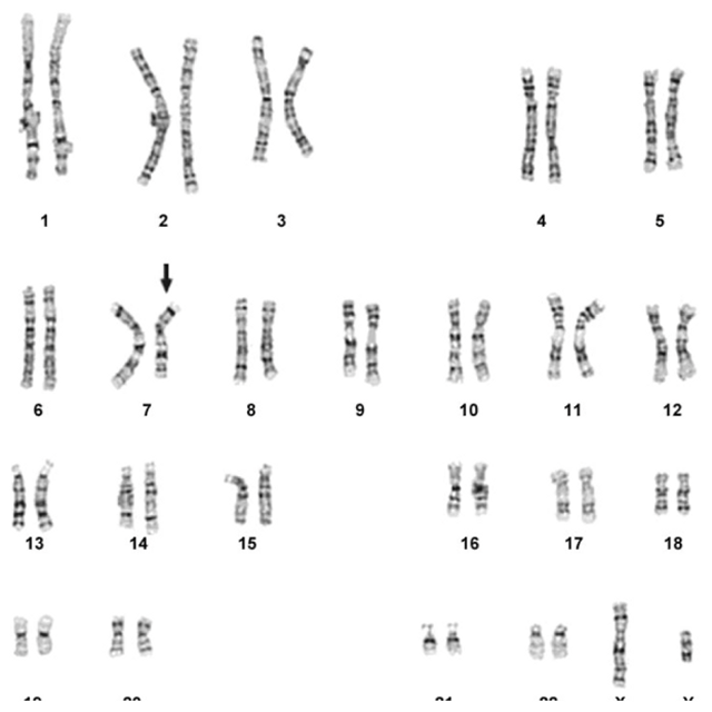 Online Karyotype Lab Ib Bio Hl Docx Online Karyotype Lab Use The