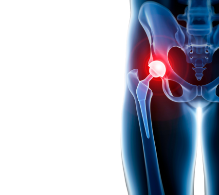 Hip 8 Binds At Interfaces Of Multiple Domains Only Present In Tchgf A