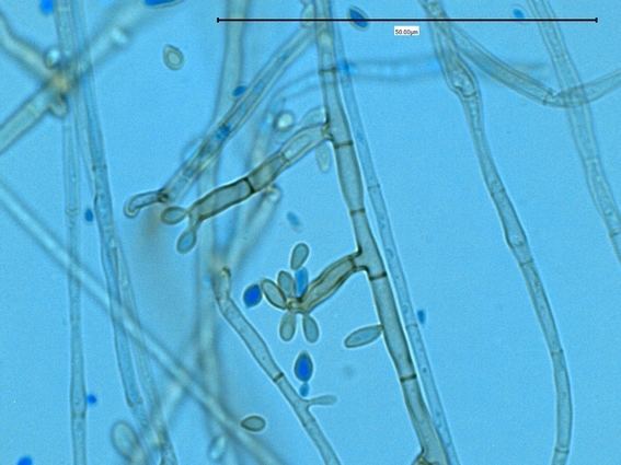 Fonsecaea Pedrosoi Sem 1