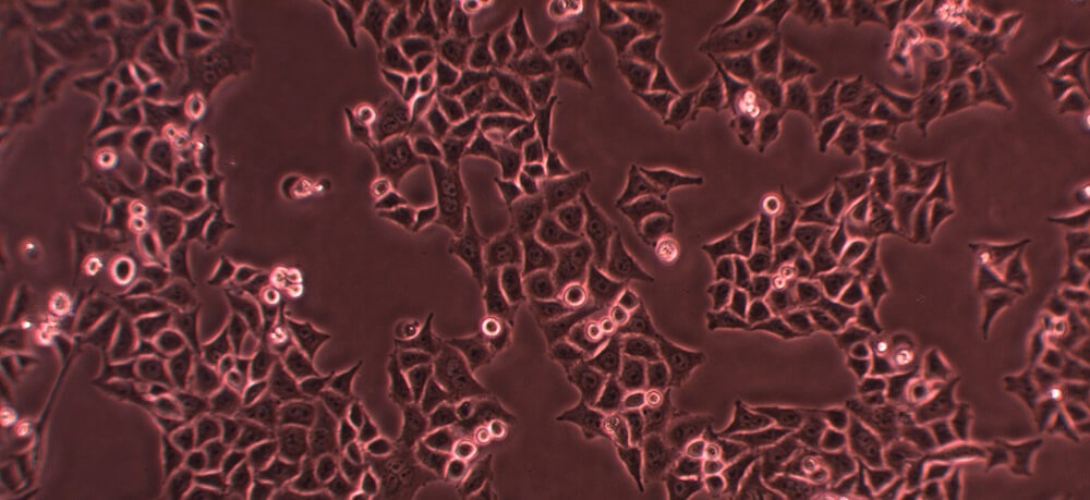 Solved 2 A Cell Line Called Hela Cells Has Been Used In Chegg Com