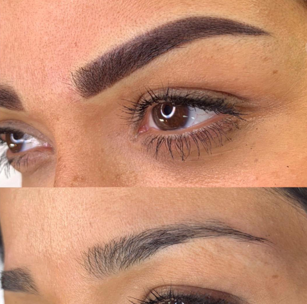 Contact Lens To Glasses Conversion Calculator