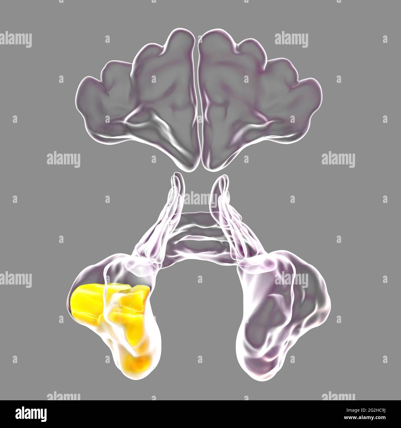 Moraxella Catarrhalis Hi Res Stock Photography And Images Alamy