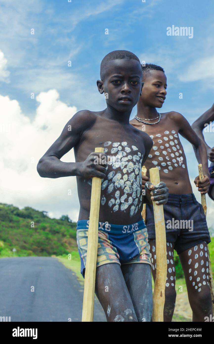 A Naked Eye And Fluorescence Turn On Sensor For Smartphone Assisted