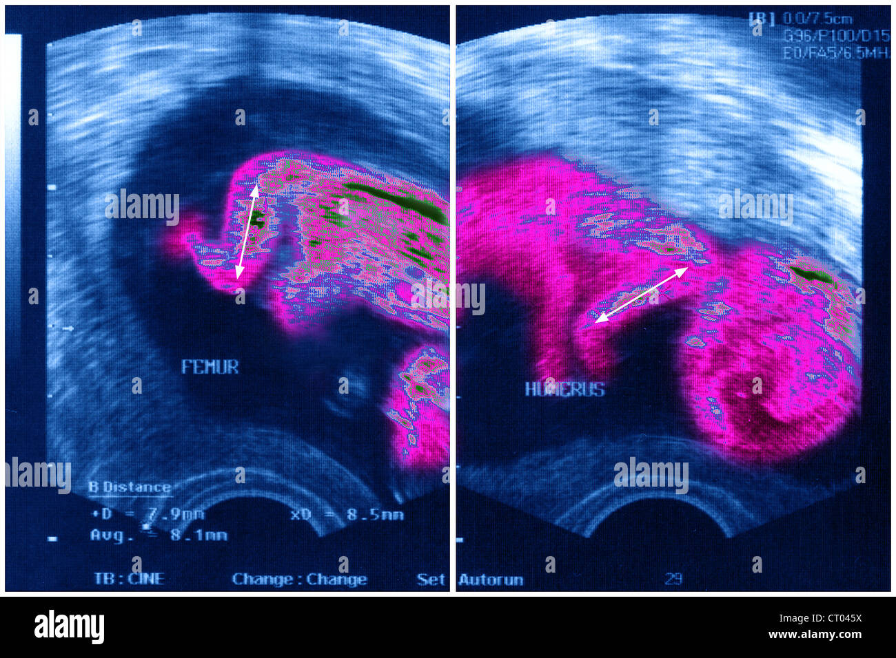 Ultrasound Assisted Extraction For Bioactive Compounds From Macroalgae