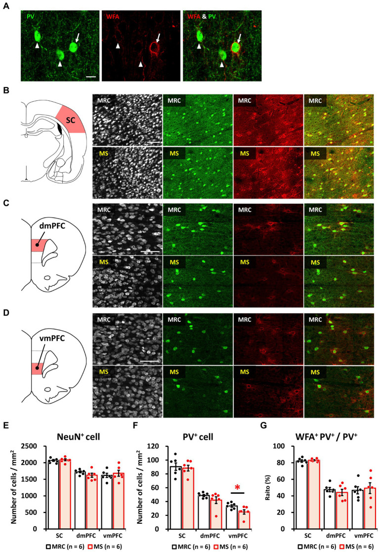 Parvalbumin Positive Interneurons In The Medial Prefrontal Cortex