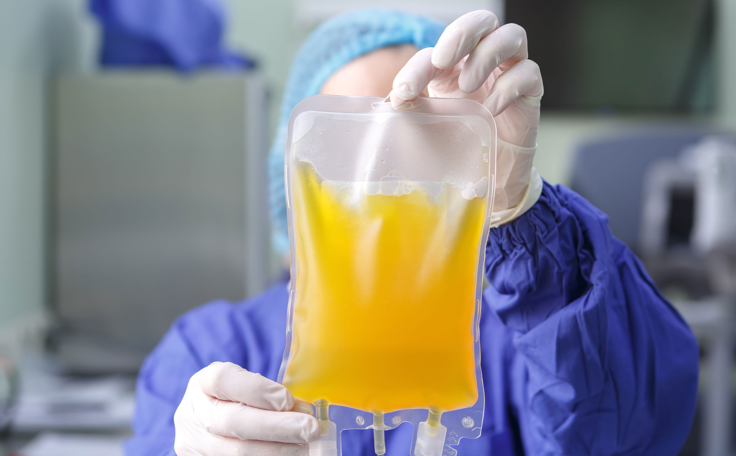 Plasma Membrane Structure Properties Lipid Rafts And Glycolipids