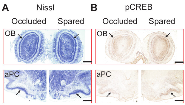 Odor Learning Affects The Relative Spatial Overlap Between Odor