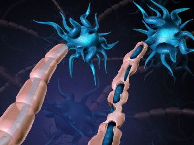 Why Is Myelination Needed On Motor Neurons