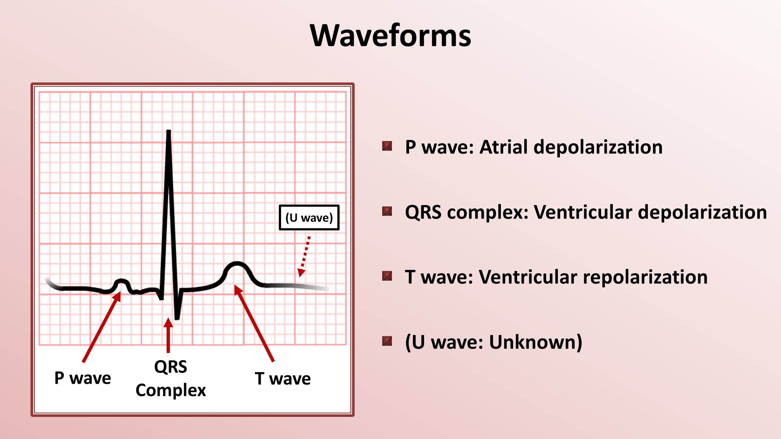 Ecg Signal Processing And Signal Quality Analysis Of Hrv Data A