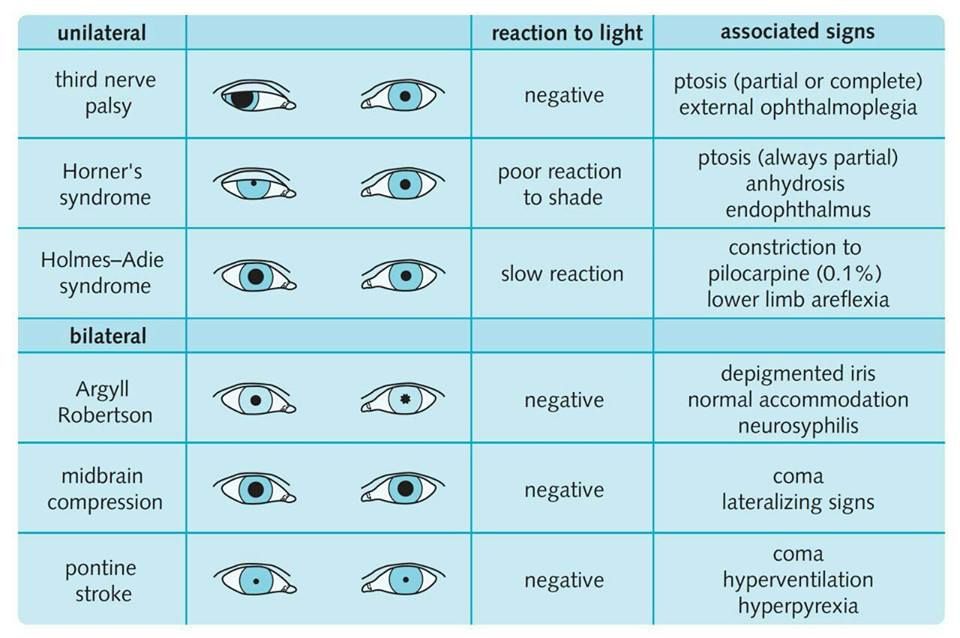 Normal Pupil Size Neuro Obs