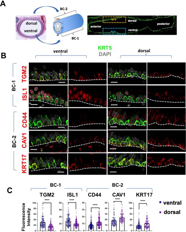 Model For Basal Body Localization Of Ift46 Newly Synthesized Ift52 And