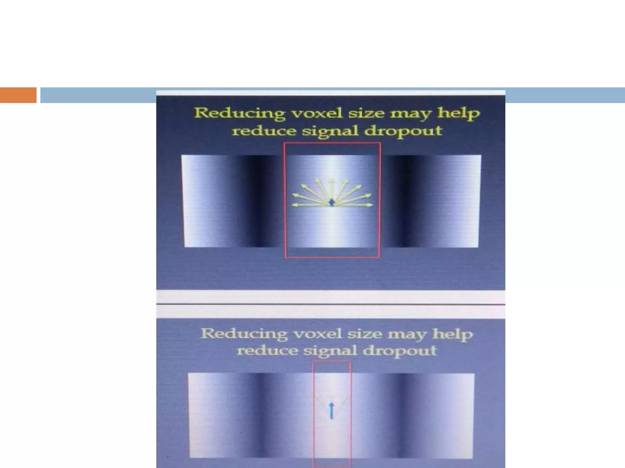 Functional Magnetic Resonance Imaging Methods Functional Magnetic