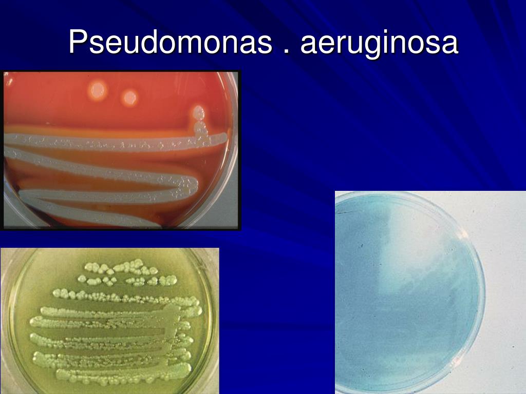 Pseudomonas Aeruginosa Strain Isolated From Different Samples