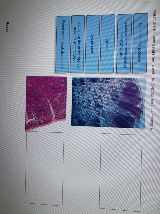 Solved Consider The Following Tissue Bioreactor Liver Cells Chegg Com