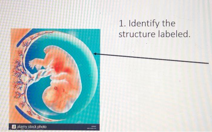 Solved 40 Identify The Structure Labeled 3 Chegg Com