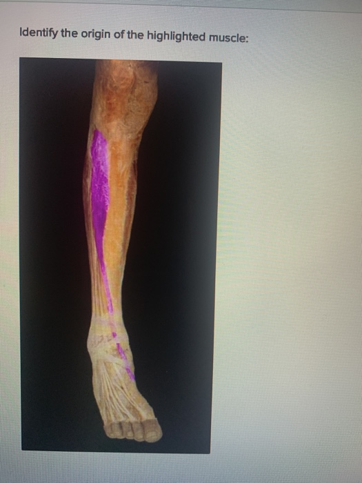 How Can I Identify And Distinguish Between Cell Culture Contamination
