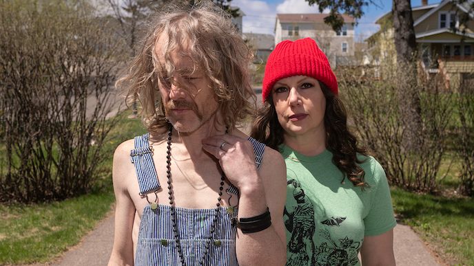 A Low Magnification Sem Image And B High Magnification Sem Image Of