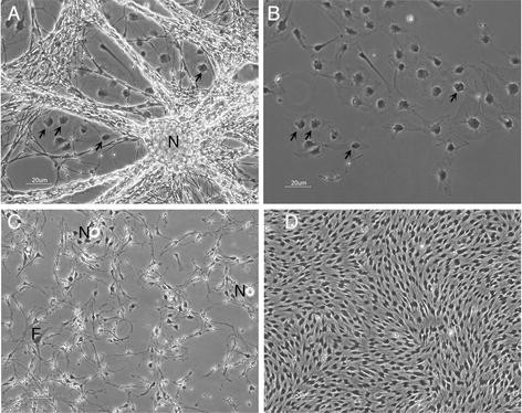 Coculture Of Schwann Cells And Granule Cells Schwann Cells Were