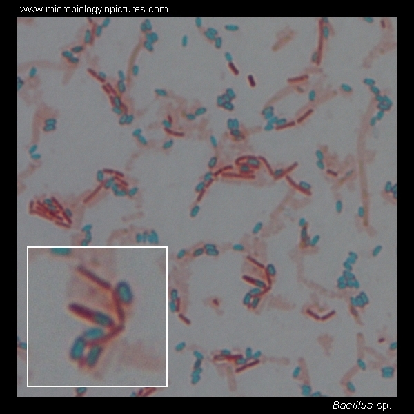 Bacillus Cereus