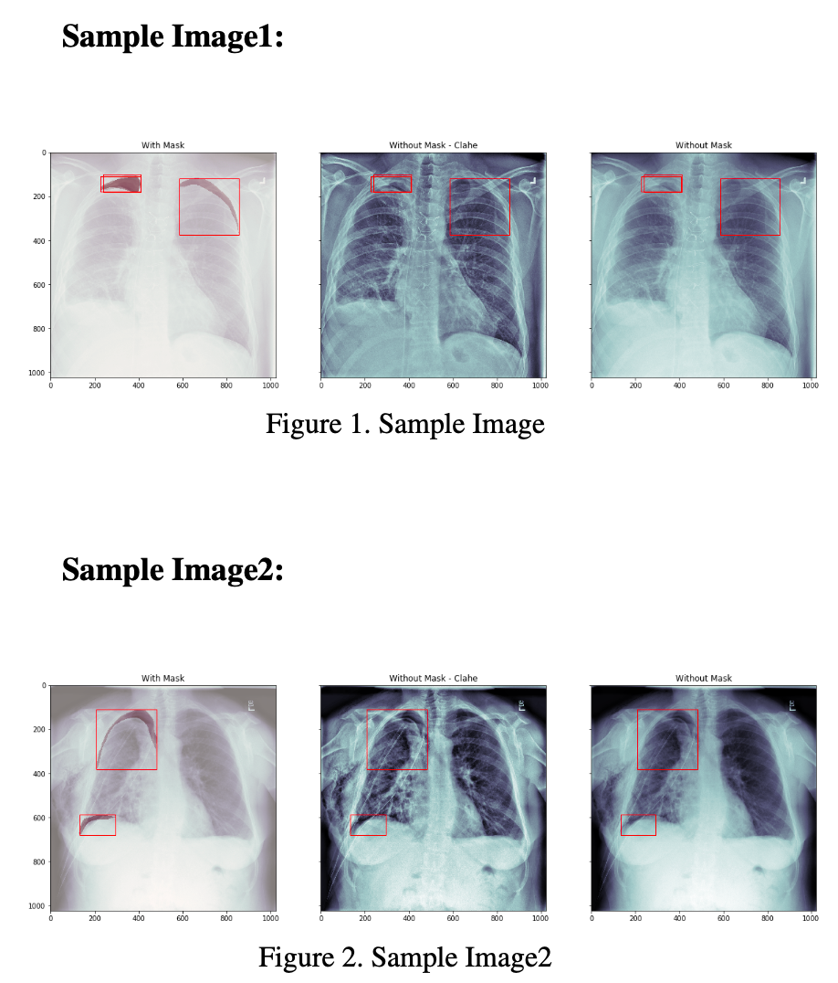 Guillaumebalezopneumothorax Segmentation Giters