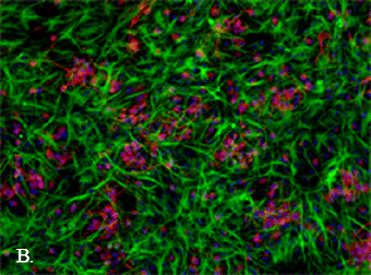 Fos Rescues Neuronal Differentiation Of Sox2 Deleted Neural Stem Cells