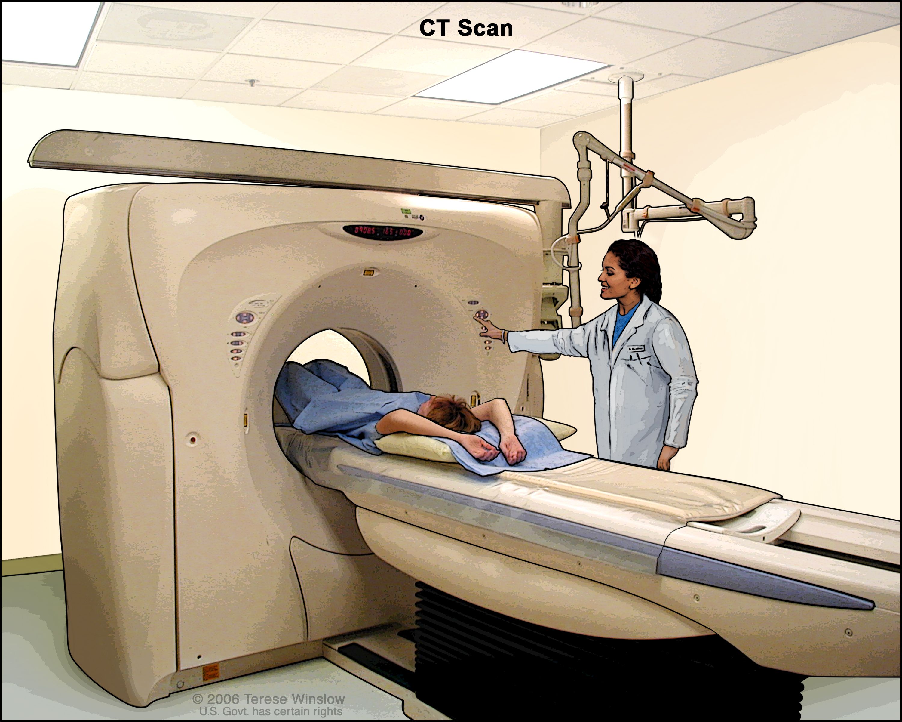 Ct Induced Intracellular Camp Production A B Quantification Of Camp