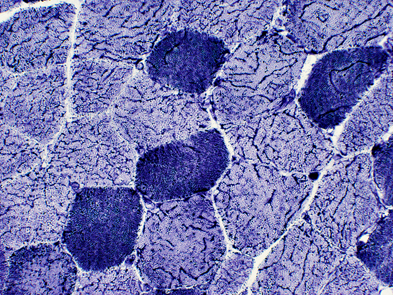 Phosphorylase T State Enzyme Stock Image A6050087 Science Photo