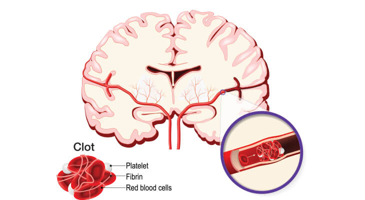 Comparison Of The Tpa Model With Different Human Atrial Models The