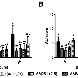 The Role Of Cb1 And Cb2 Receptor In The Process Of Apoptosis In Lung