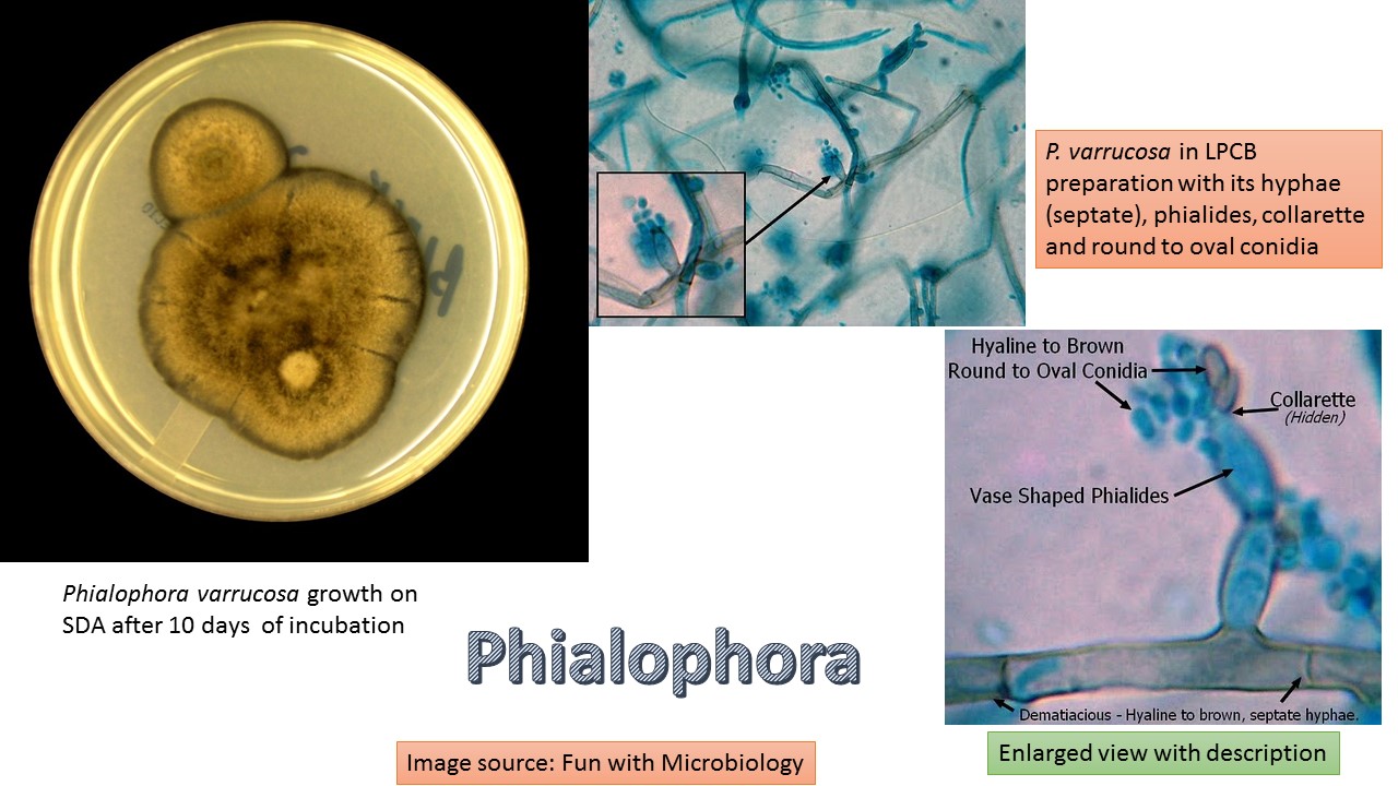 Phialophora Verrucosa Plos One