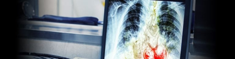 Vesa Displayhdr Vs Hdr10