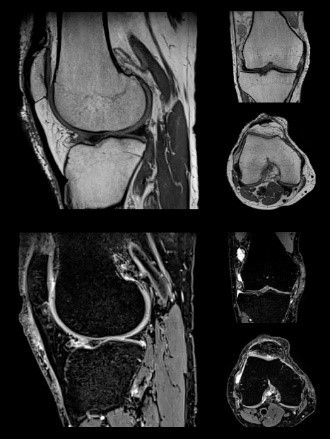 Volumetric Magnetic Resonance Imaging Saudi Mri Tech