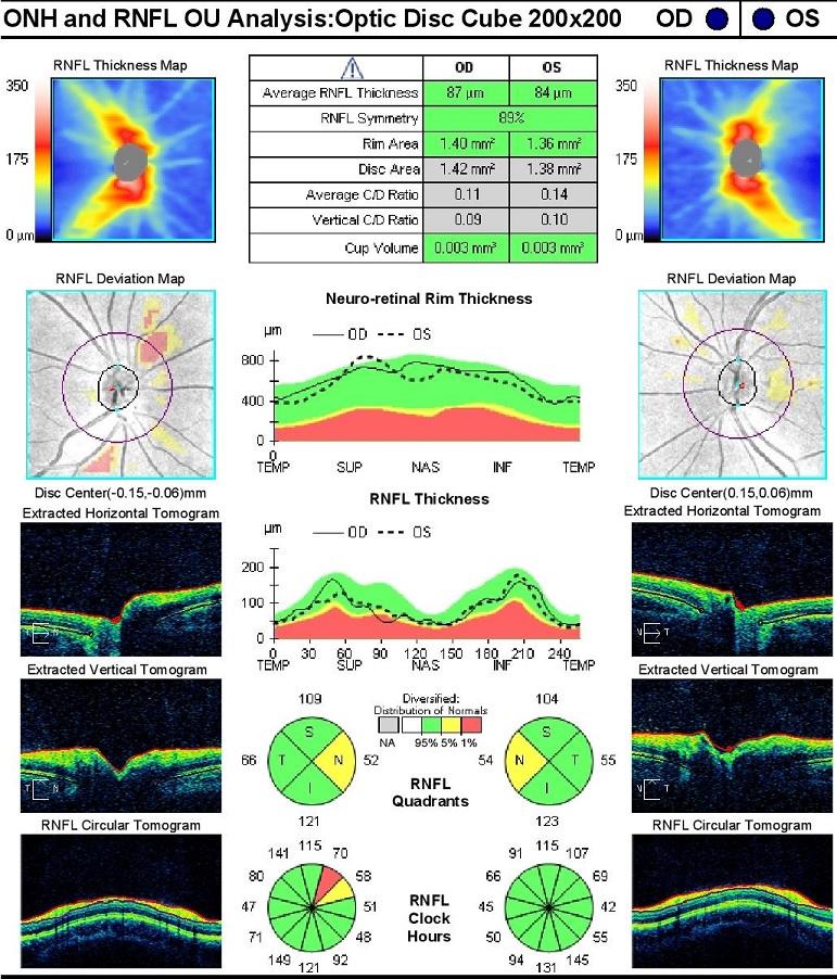 Oct Spectrometer Industry Leading Manufacturer