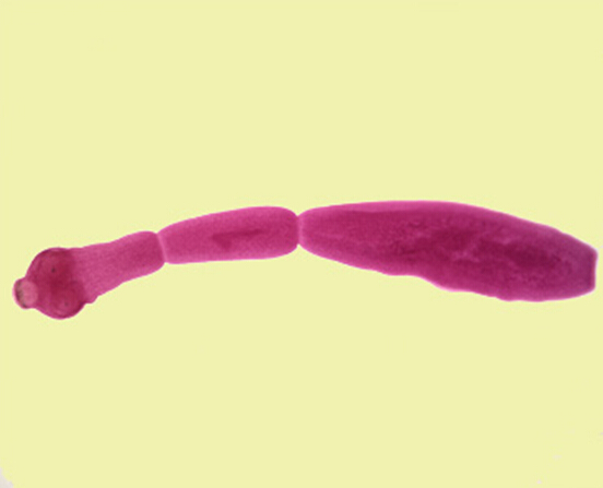 Echinococcus Granulosus Parasitology European Medical Alliance