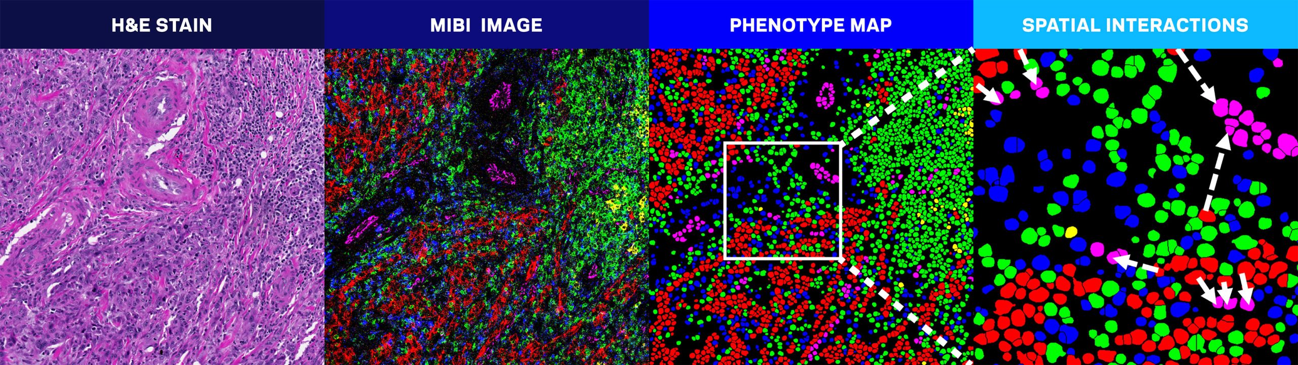Spatial Biology Gives A Clear View On Gene Therapy