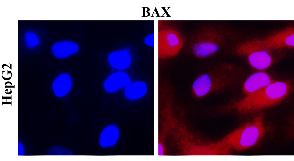 Bax And Bcl2 Mrna Expressions In Neonatal Rat Hippocampus