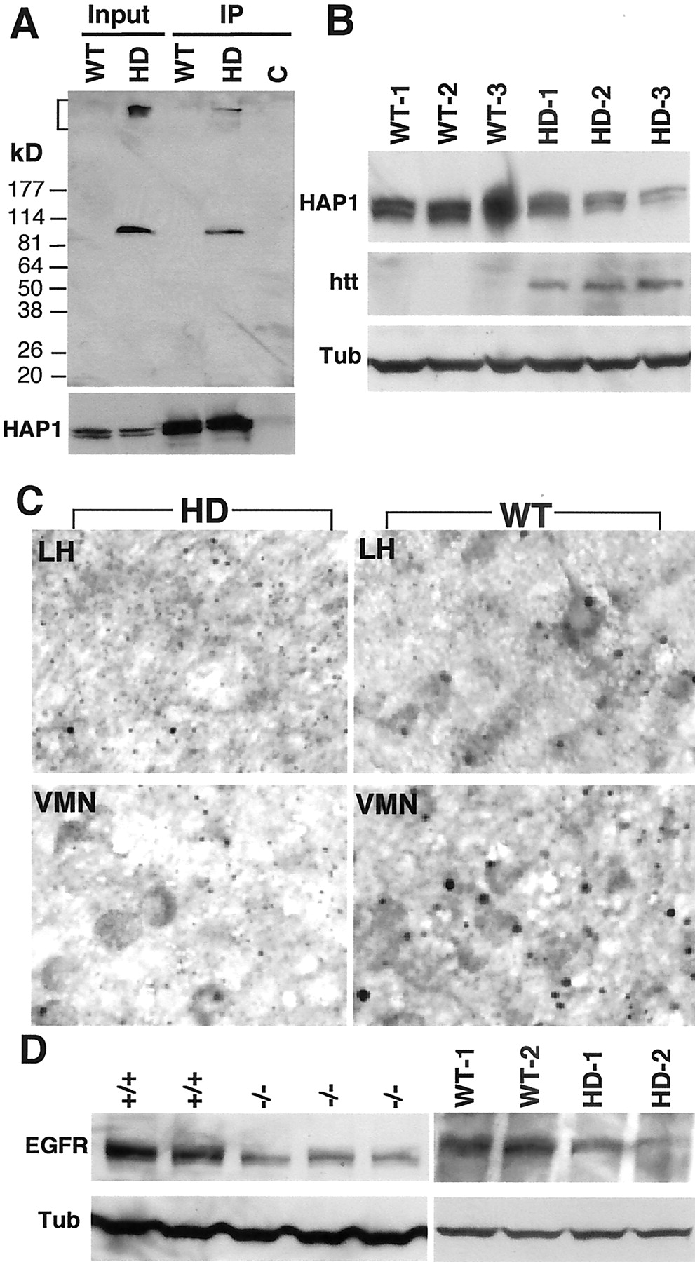 Pdf Huntingtin Associated Protein 1 Ameliorates Neurological Function