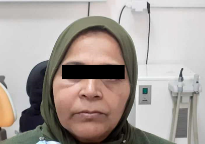 Guidelines For Management Of Sodium Hypochlorite Extrusion Injuries Pptx