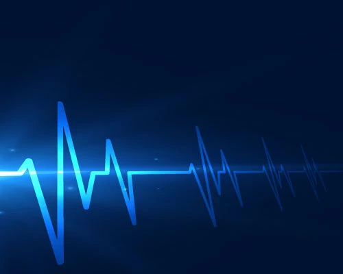 The Pulse Tonometric Device And Illustration Of Pulse Signal
