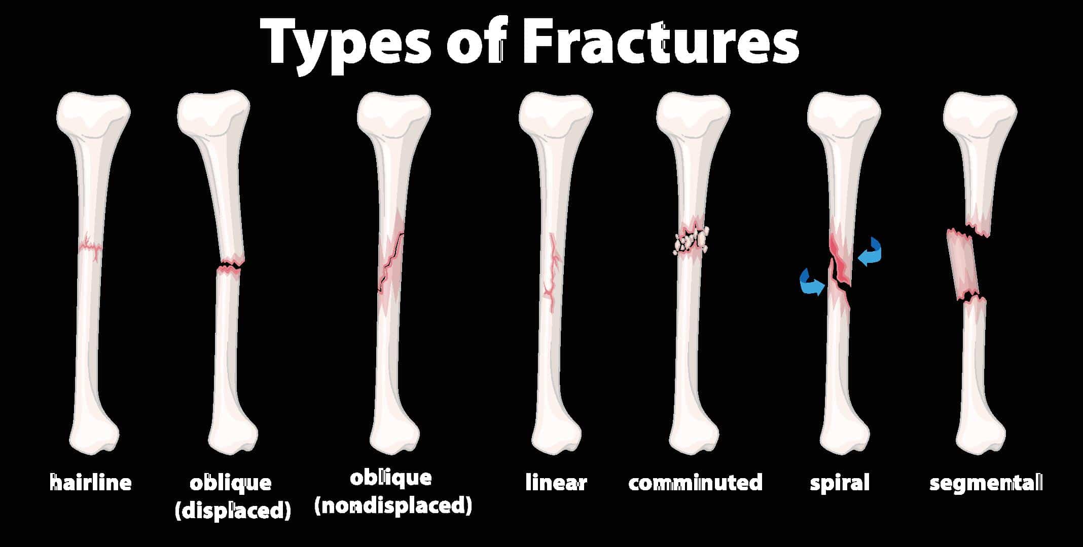 Fracture Morphology For Impact Specimens A Wm As Welded B Wm After