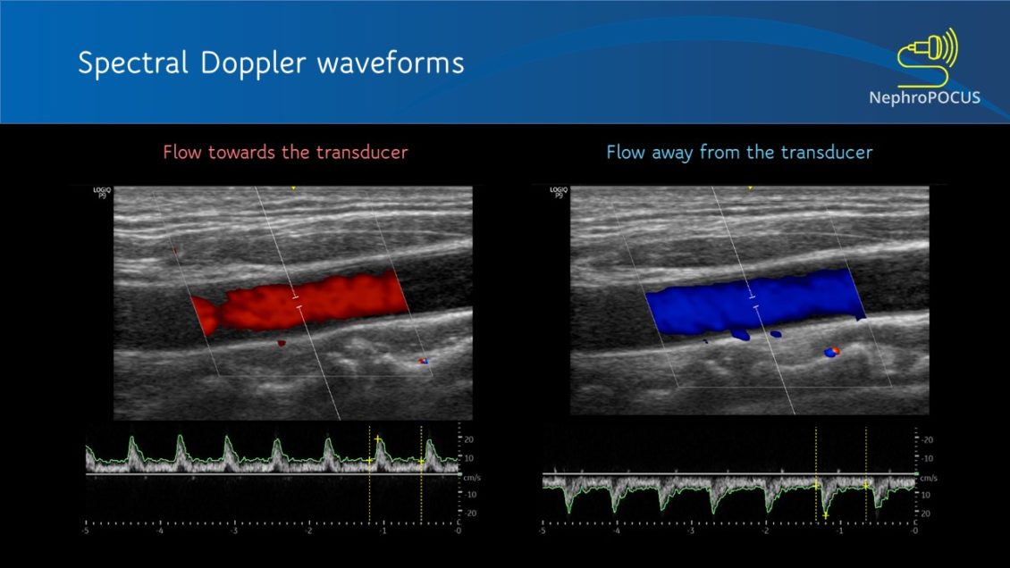 Doppler Resonance Lidar Promises Advances In Sensitivity And Real Time