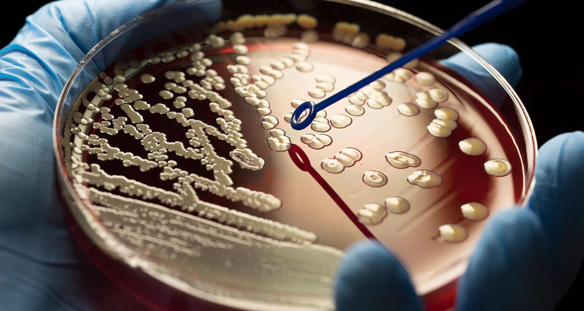 Microbiology Testing Market Size Share Forecast 2027 Mrfr
